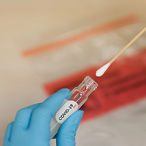 Исследования на наличие антител к инфекции COVID-19