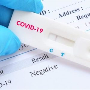 Лабораторное тестирование на инфекцию COVID-19