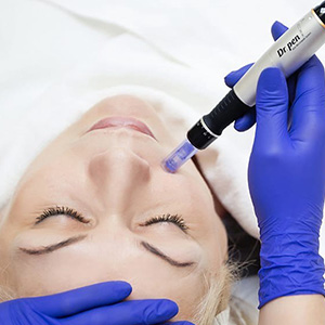Фракционная мезотерапия