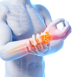 Процедуры при заболеваниях костно-мышечной системы