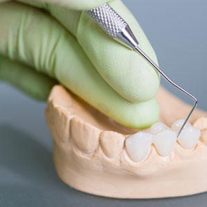 Реставрация коронковой части зуба