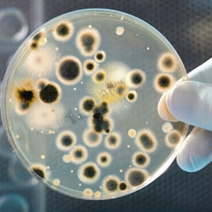 Бактериологические анализы