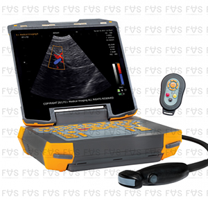 УЗИ-сканер IBEX EVO II