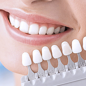 Протезирование зубов (коронки и мосты)