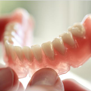 Протезирование зубов съемными конструкциями