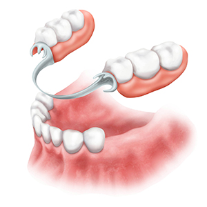 Зубопротезную стоматология