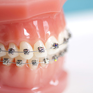 Стоматология ортодонтическая
