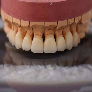Зуботехнические работы