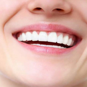 Реставрация и наращивание зубов