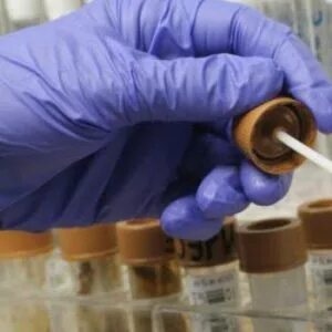 Лабораторные исследования