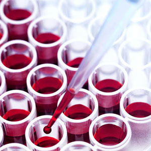 Серологические исследования