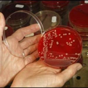 Бактериологические исследования
