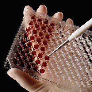 Серологические исследования