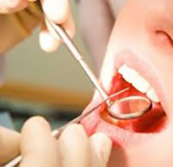 Чистка зубов ручным методом