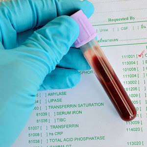Исследование крови на содержание иммуноглобулинов